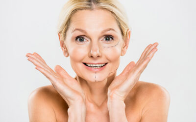 Natural Facelift Results: Why Tissue Release and Low Tension Are Essential